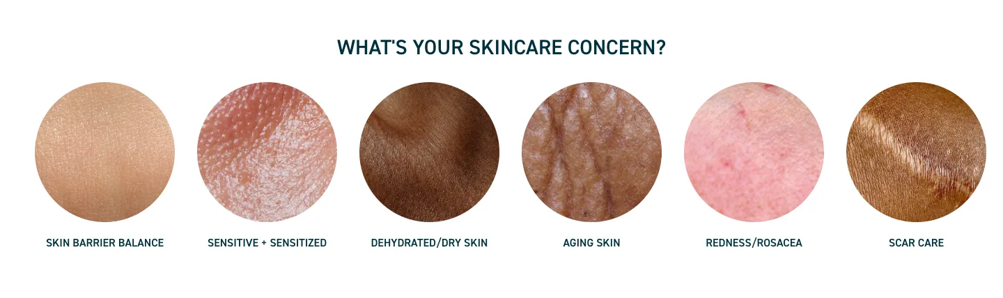 What's your skincare concern? from Prequel