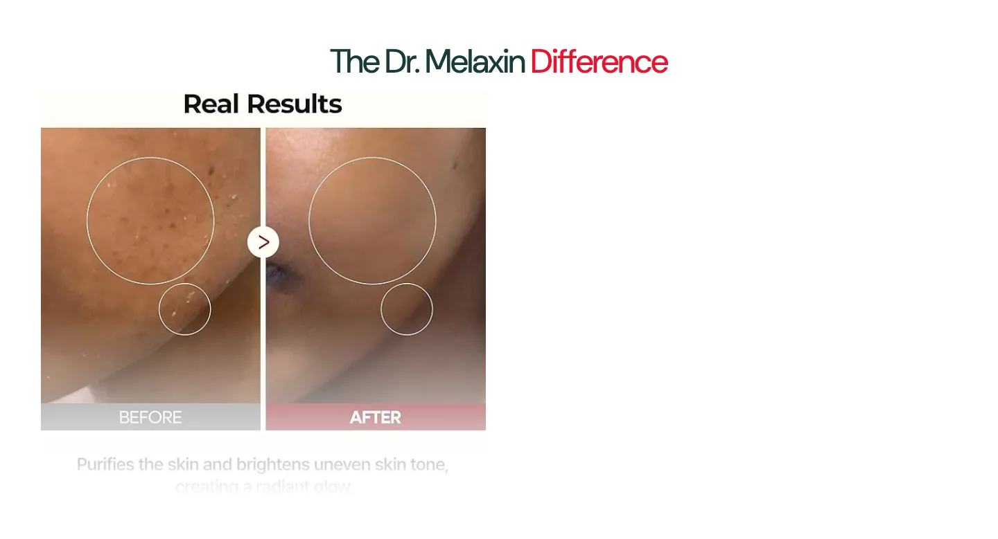 Real results slider from Dr. Melaxin